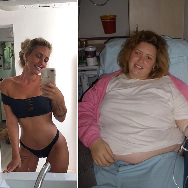 2רייצ'ל לאור לפני ואחרי שהשילה 60 קג ממשקלה